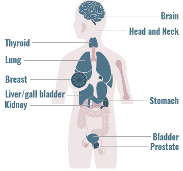 Distribution of FGFR 1,2,3 gene fusions across primary tumor sites graphic